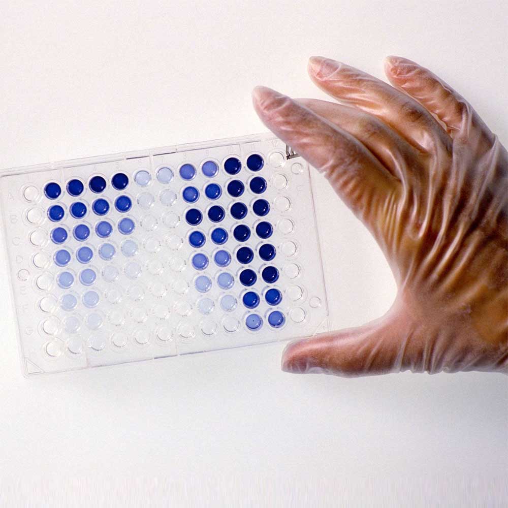 HISTAMINE FOOD ELISA KIT